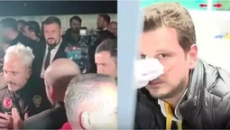 Охоронець президента Бешикташа побив журналіста (+ВІДЕО)