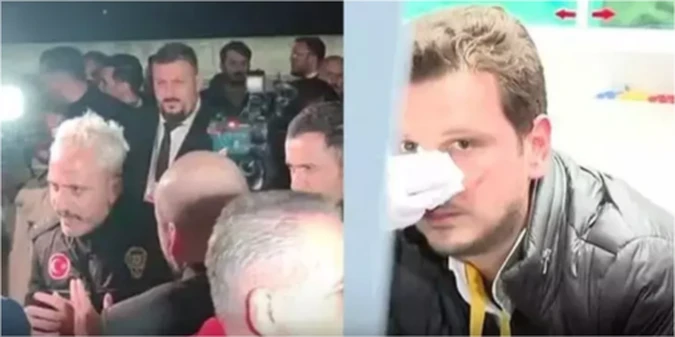 Охоронець президента Бешикташа побив журналіста (+ВІДЕО)