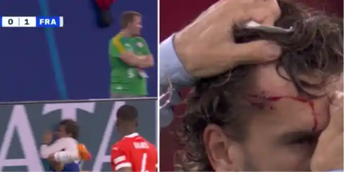 Грізманну розбили голову, Мбаппе зламали ніс під час матчу Австрія - Франція