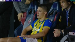 Сікан показав фото перелому носа після матчу з Болоньєю у Лізі чемпіонів (+ФОТО)